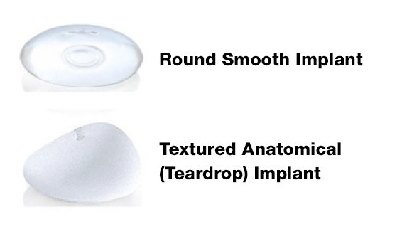 Breast Implant Texture