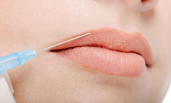 Dermal fillers for the lips get great results in Melbourne