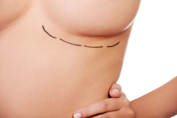 medicare-rebate-breast-surgery-tummy-tuck-combined-mummymakeover