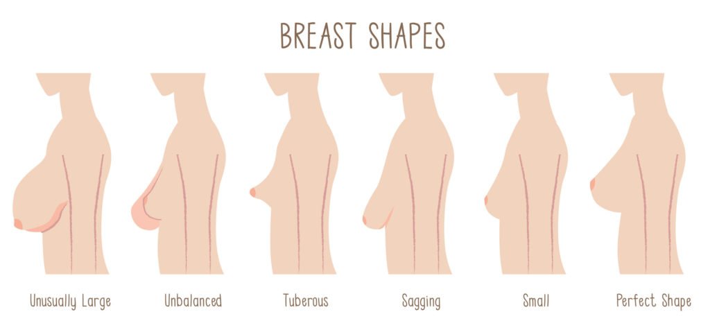 tubular-breasts-surgery-melbourne-breast-shapes