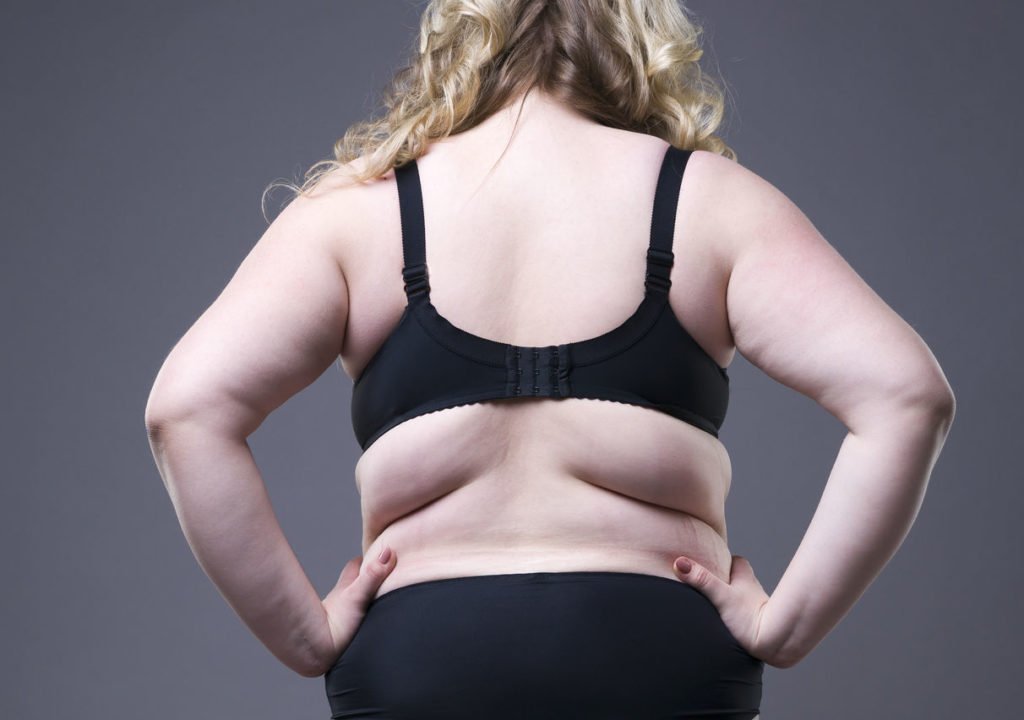 back-fat-or-armpit-fat-bra-bulges-liposuction