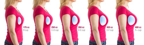 Breast Implant size comparison