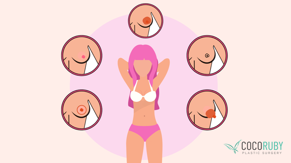 Coco Ruby Plastic Surgery- What make beautiful breast blog - Nipple Styles and Sizes Illustration Image